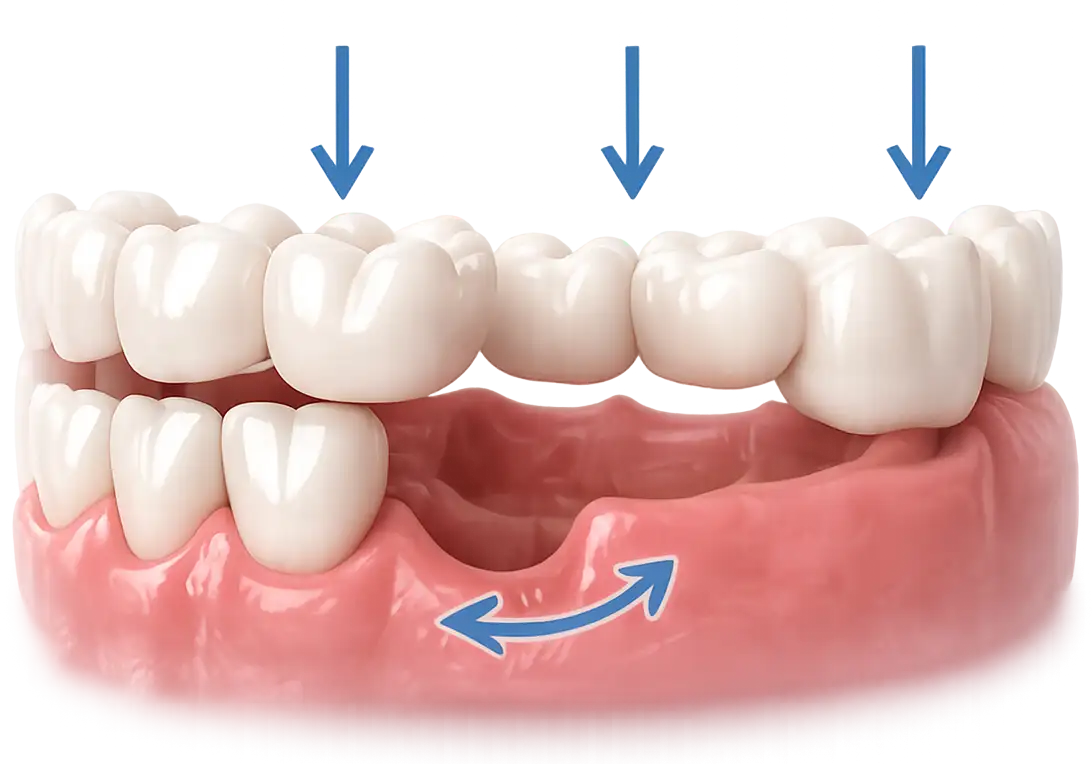 Problème de mastication